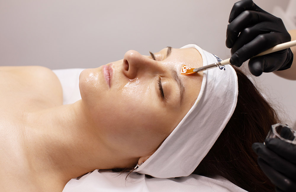 Young woman's skin care: facial chemical peel therapy.