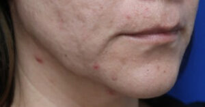 FACEology Lift / Neck Lift