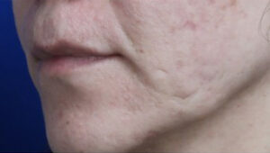 FACEology Lift / Neck Lift